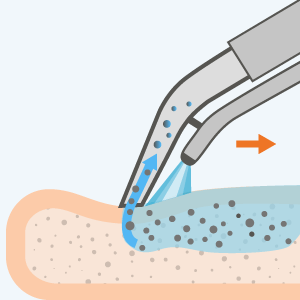 Pranie tapicerki meblowej – metoda ekstrakcyjna Cleaning Step proczysto.live